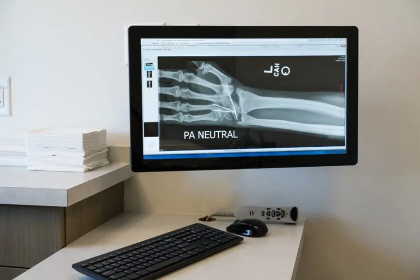 Boston Carpal Tunnel Questionnaire Thumbnail