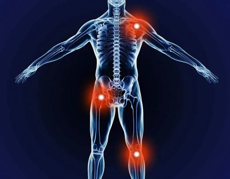 Forgotten Joint Score Blog