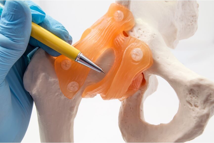 Hip replacement model