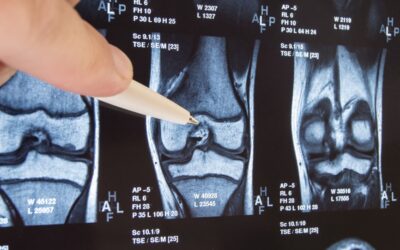 KOOS Knee Score