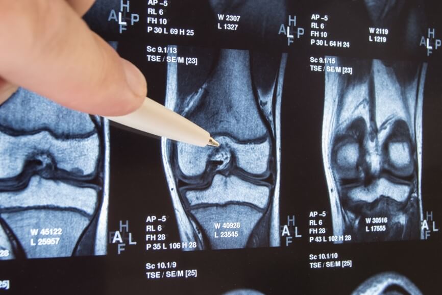 pencil pointing at a knee on an xray