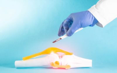 CMS Issues New THA/TKA PRO-PM in the FY 2023 Hospital IPPS
