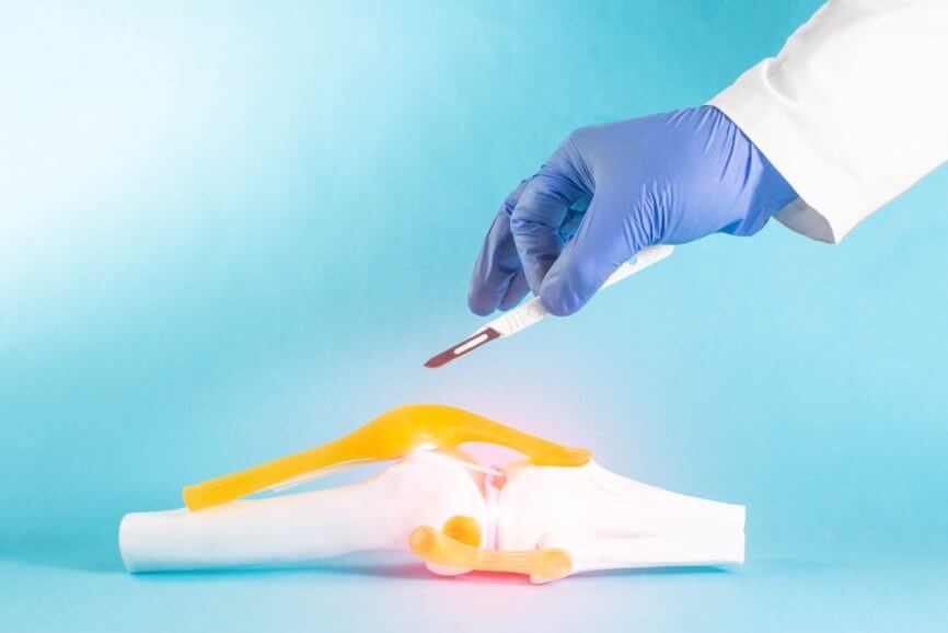 THA/TKA PROPM in the FY 2023 Hospital IPPS Issued by CMS