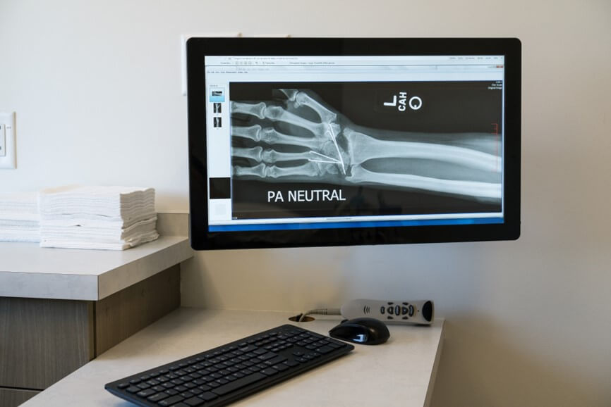 xray of arm on TV screen in a medical room