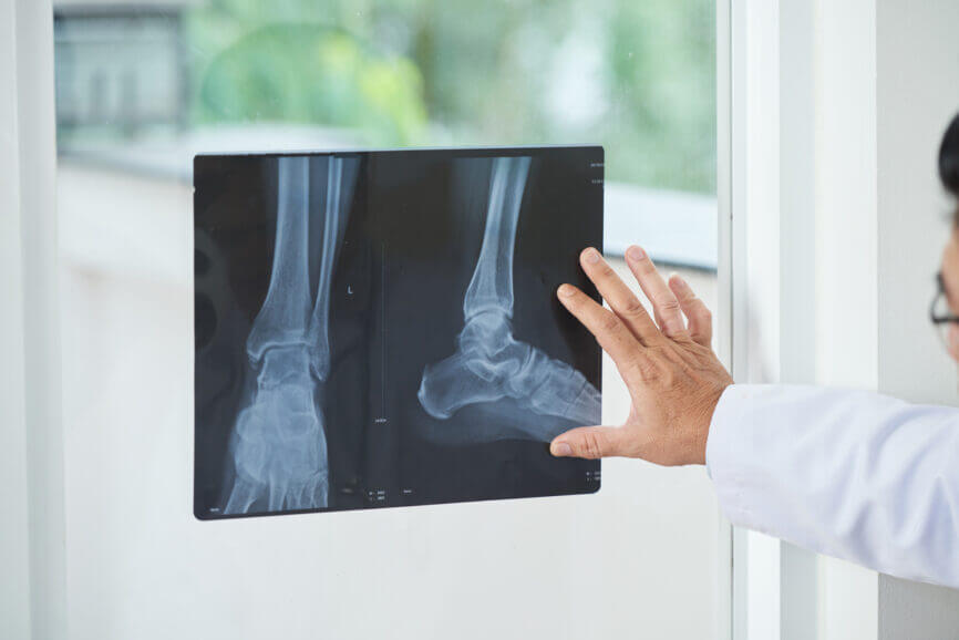 Medical practitioner examining X-ray picture of ankles near window in doctor's office