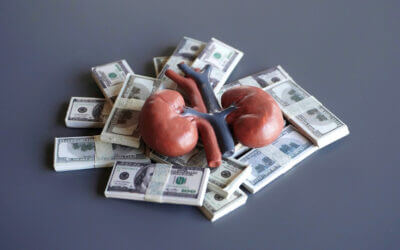 Addressing the Gaps in Kidney Transplantation with the IOTA Model