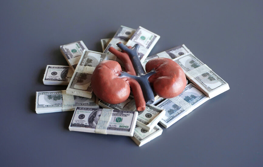 MBG 033 IOTA blog featured image