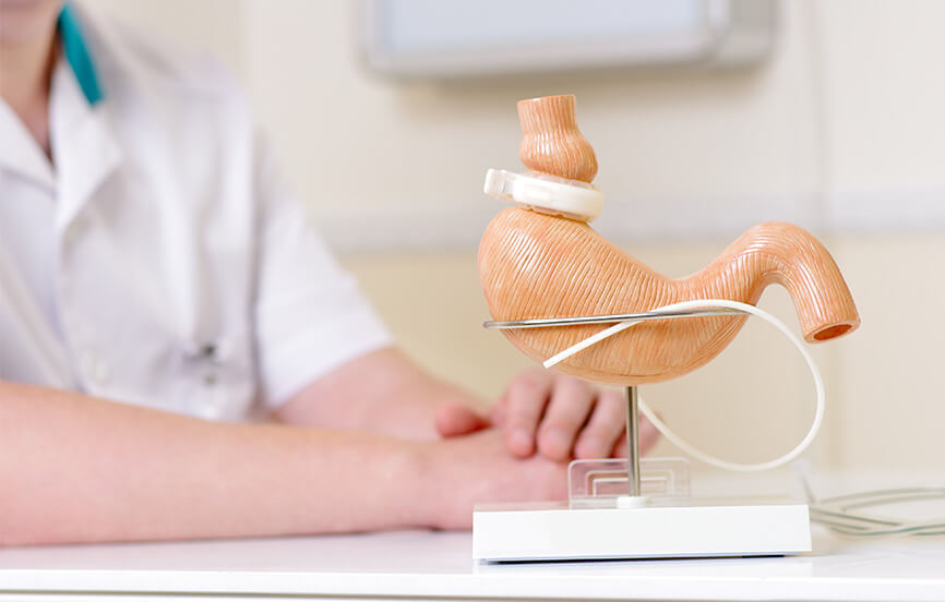 MBSAQIP blog featured image